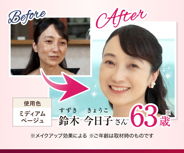 Before After 鈴木 今日子さん63歳