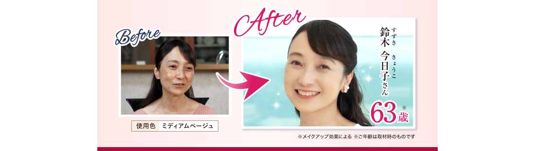 Before After 鈴木 今日子さん63歳