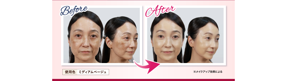 Before After 鈴木 今日子さん63歳