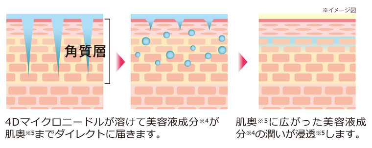 美・皇潤パーフェクト マイクロニードルパッチ（口元・ひたい用） 単品